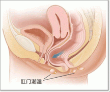 肛门潮湿示意图